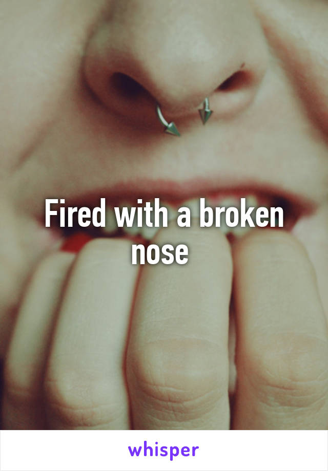 Fired with a broken nose 