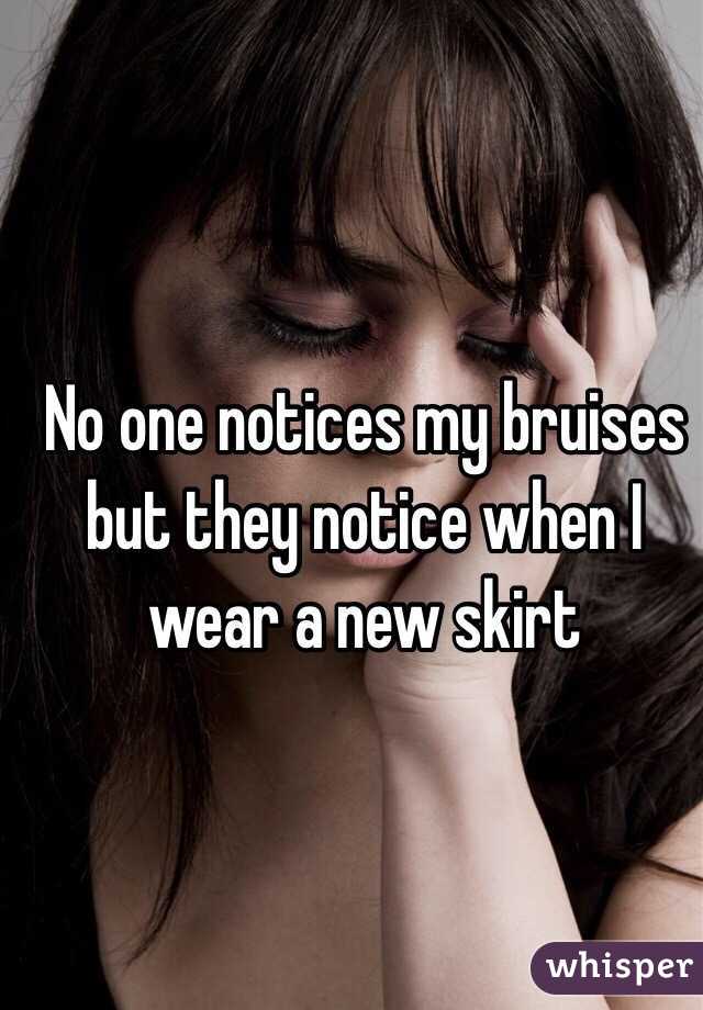 No one notices my bruises but they notice when I wear a new skirt