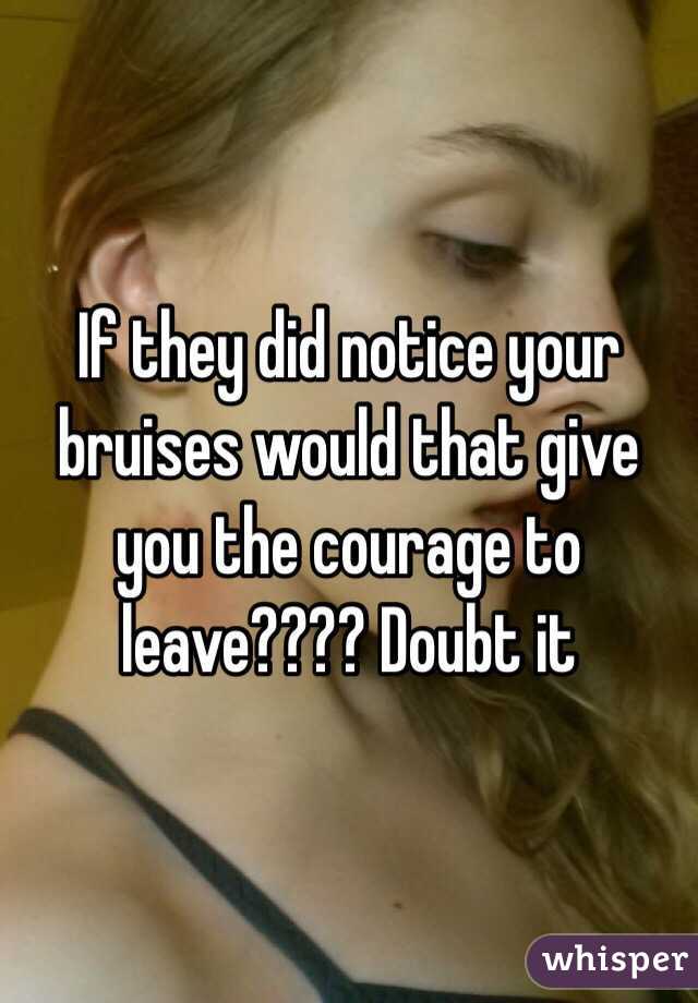 If they did notice your bruises would that give you the courage to leave???? Doubt it 