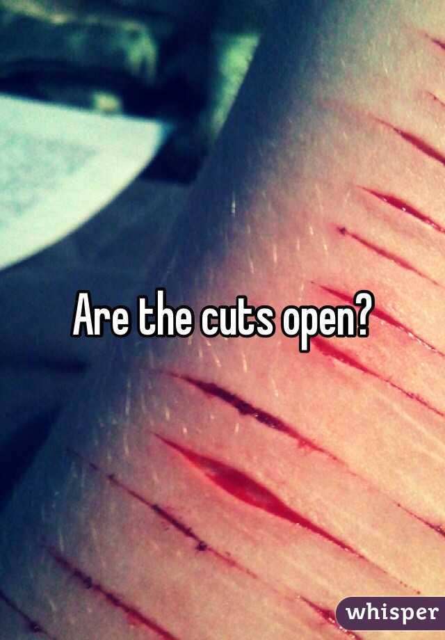 Are the cuts open?