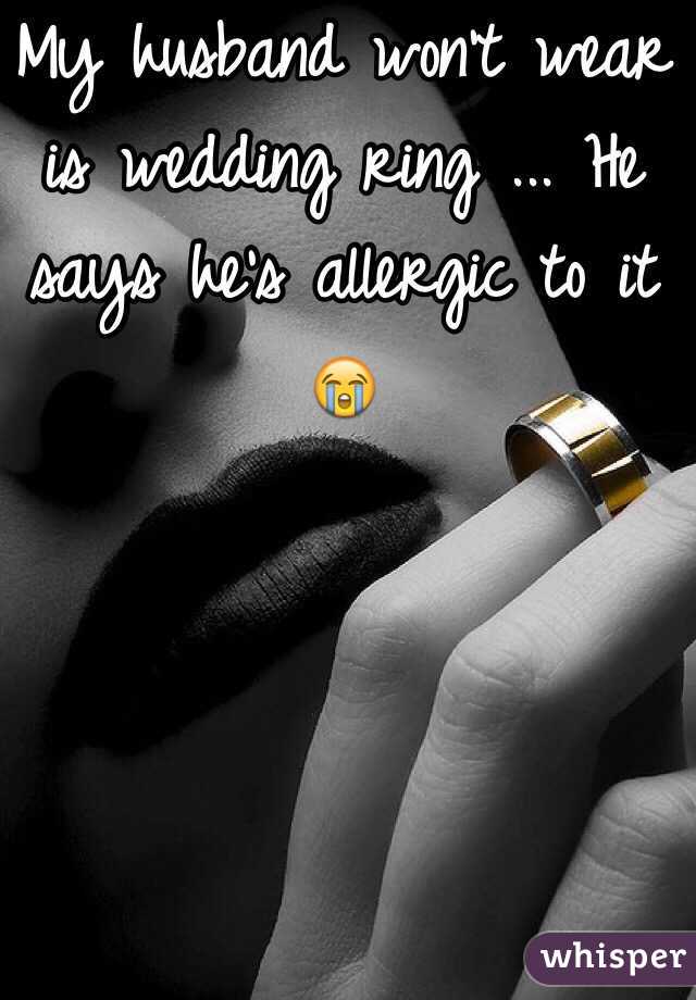 My husband won't wear is wedding ring ... He says he's allergic to it 😭