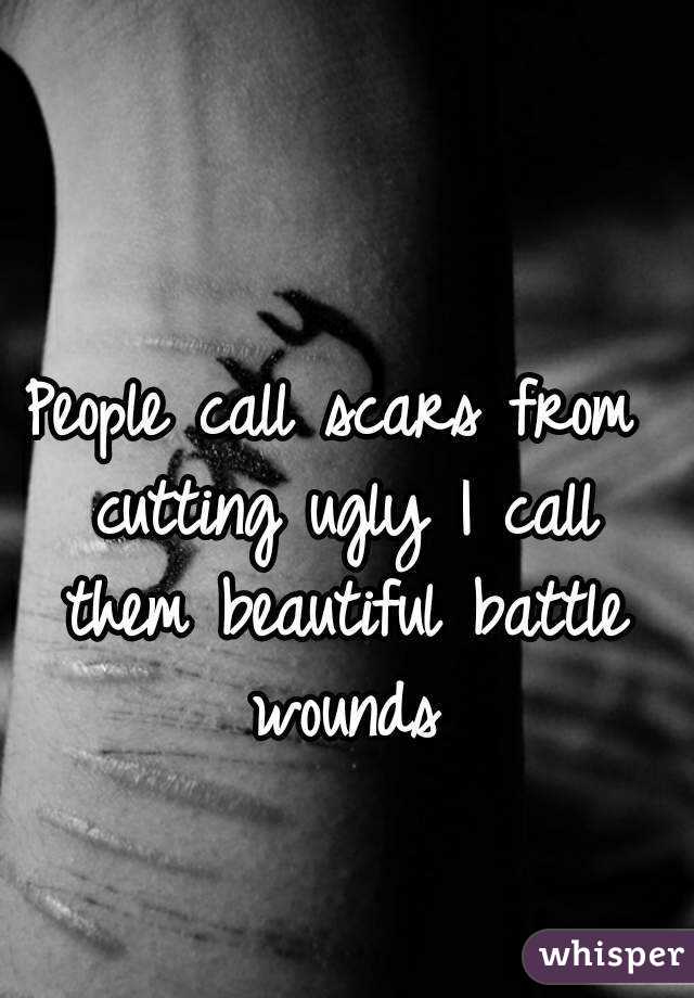 People call scars from cutting ugly I call them beautiful battle wounds