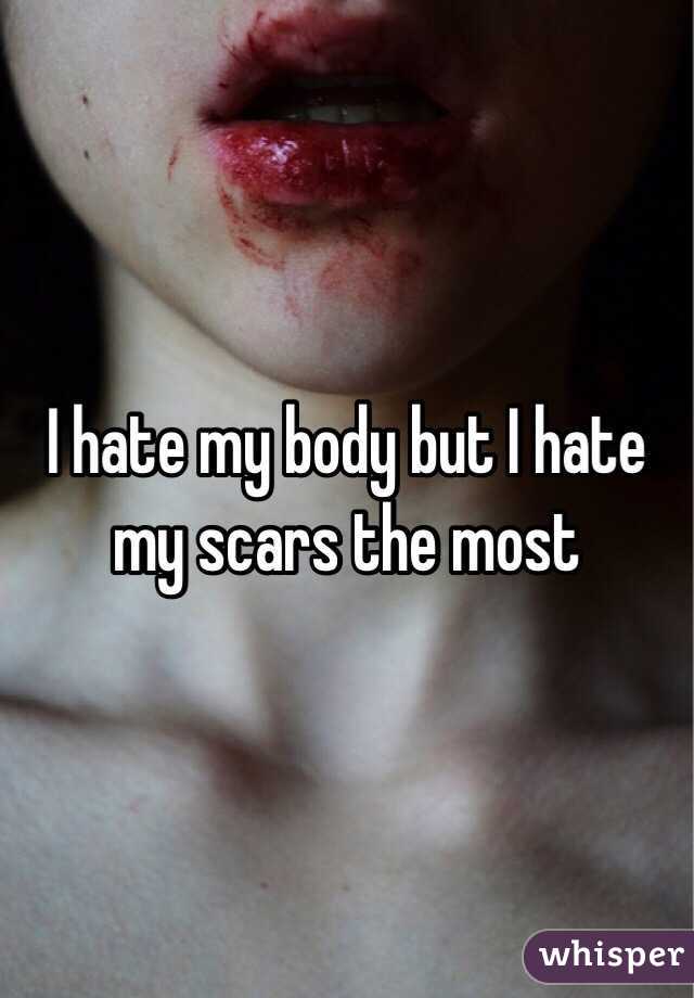 I hate my body but I hate my scars the most
