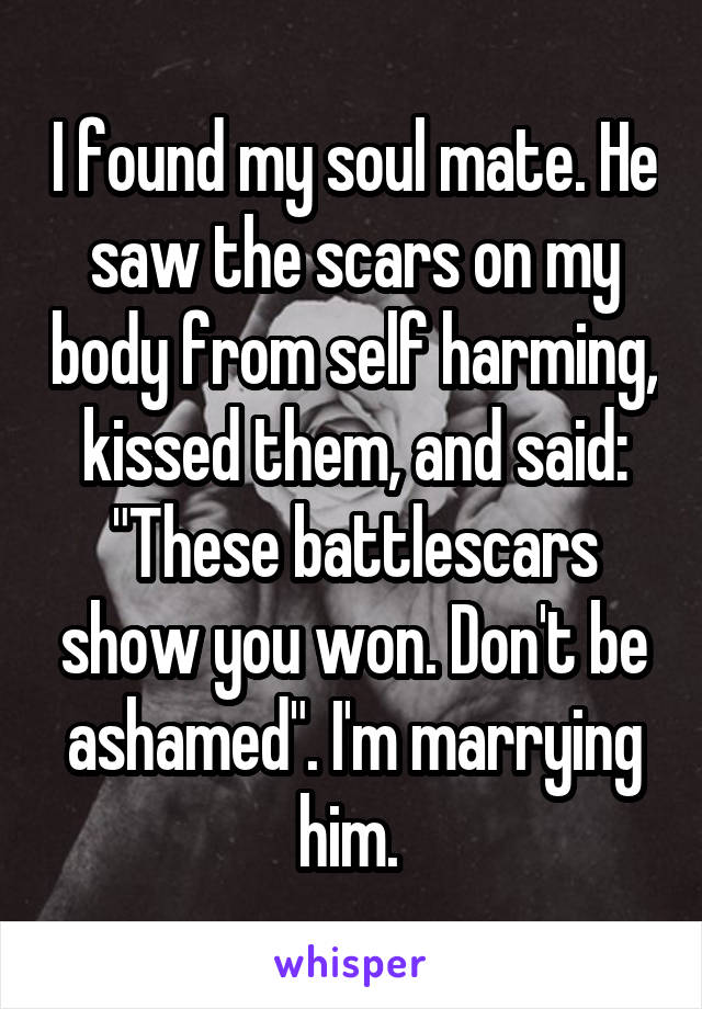 I found my soul mate. He saw the scars on my body from self harming, kissed them, and said: "These battlescars show you won. Don't be ashamed". I'm marrying him. 