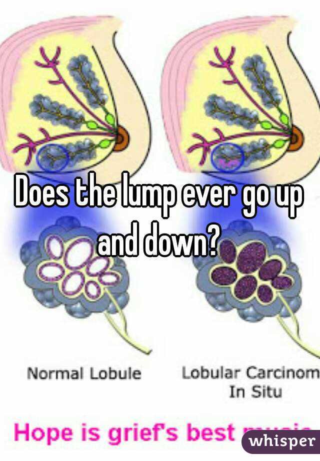 Does the lump ever go up and down? 