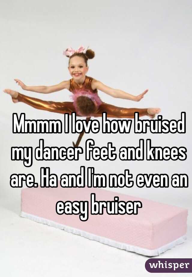 Mmmm I love how bruised my dancer feet and knees are. Ha and I'm not even an easy bruiser
