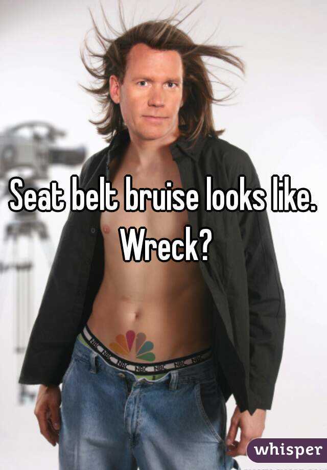 Seat belt bruise looks like. Wreck?