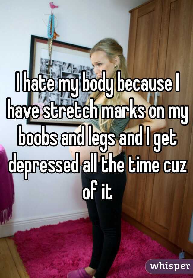 I hate my body because I have stretch marks on my boobs and legs and I get depressed all the time cuz of it