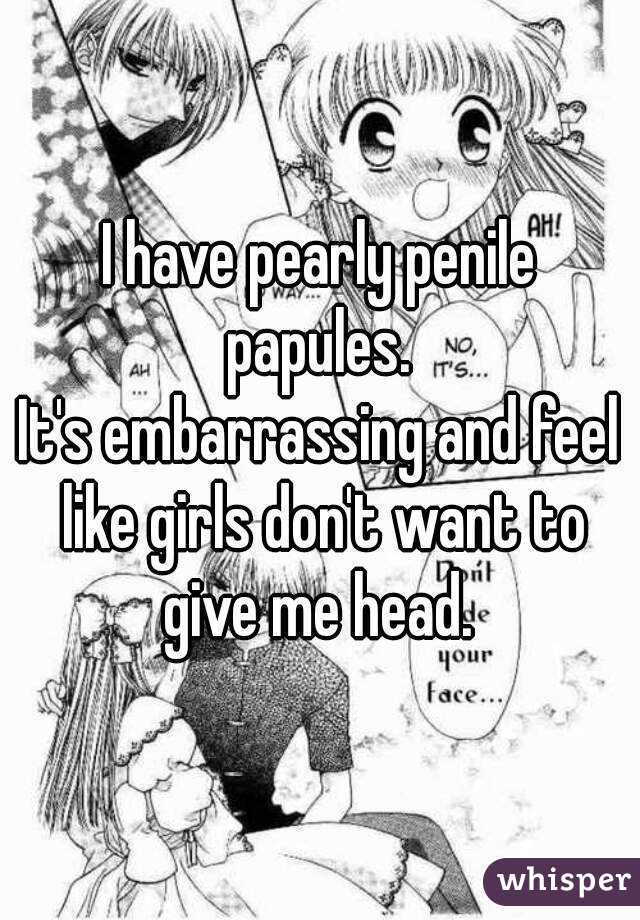 I have pearly penile papules. 
It's embarrassing and feel like girls don't want to give me head. 