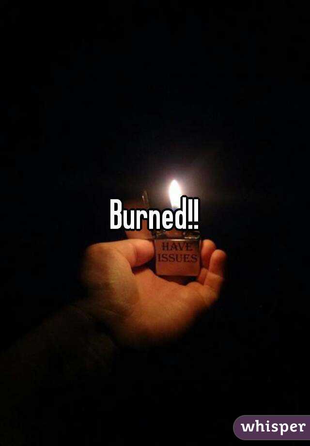 Burned!!