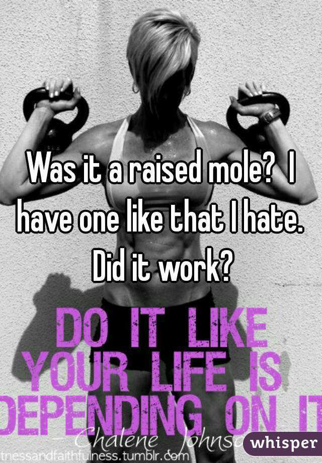 Was it a raised mole?  I have one like that I hate.  Did it work?