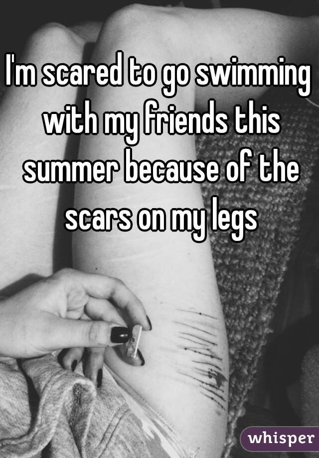 I'm scared to go swimming with my friends this summer because of the scars on my legs