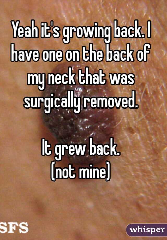 Yeah it's growing back. I have one on the back of my neck that was surgically removed. 

It grew back. 
(not mine)