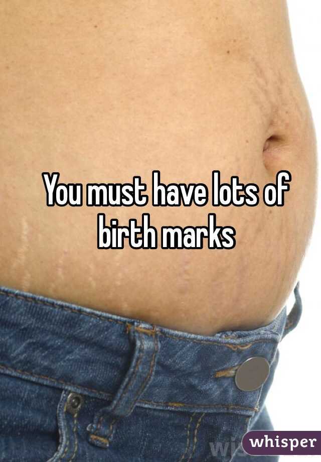 You must have lots of birth marks