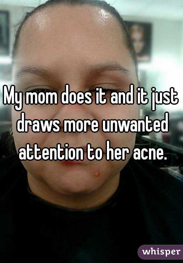 My mom does it and it just draws more unwanted attention to her acne.