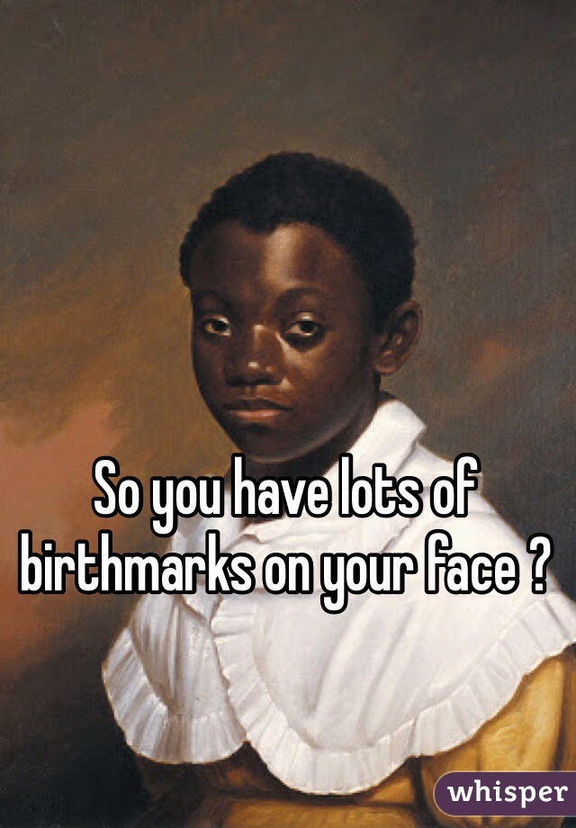 So you have lots of birthmarks on your face ? 