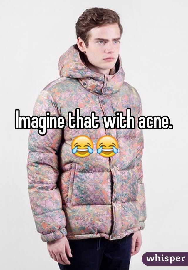 Imagine that with acne.
😂😂