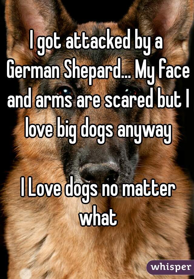 I got attacked by a German Shepard... My face and arms are scared but I love big dogs anyway

 I Love dogs no matter what
