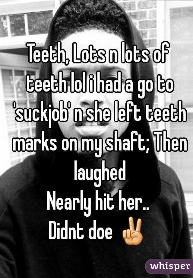 Teeth, Lots n lots of teeth lol i had a go to 'suckjob' n she left teeth marks on my shaft; Then laughed
Nearly hit her..
Didnt doe ✌