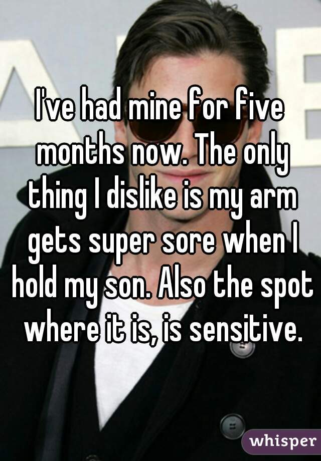 I've had mine for five months now. The only thing I dislike is my arm gets super sore when I hold my son. Also the spot where it is, is sensitive.