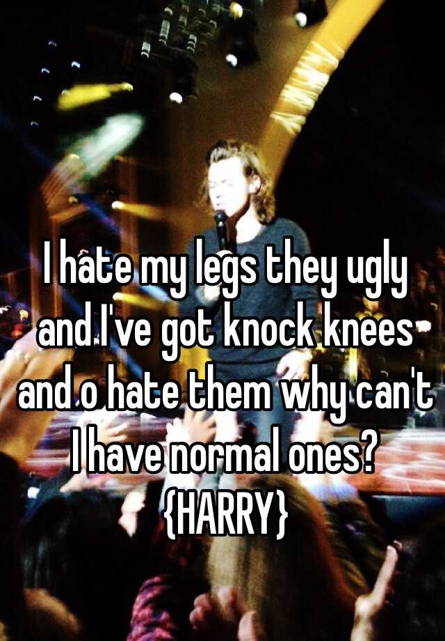 I hate my legs they ugly and I've got knock knees and o hate them why can't I have normal ones? {HARRY}