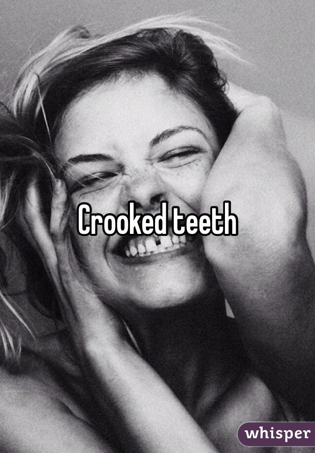 Crooked teeth 