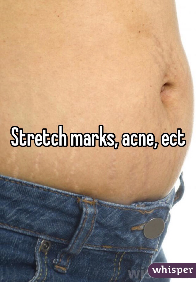 Stretch marks, acne, ect 
