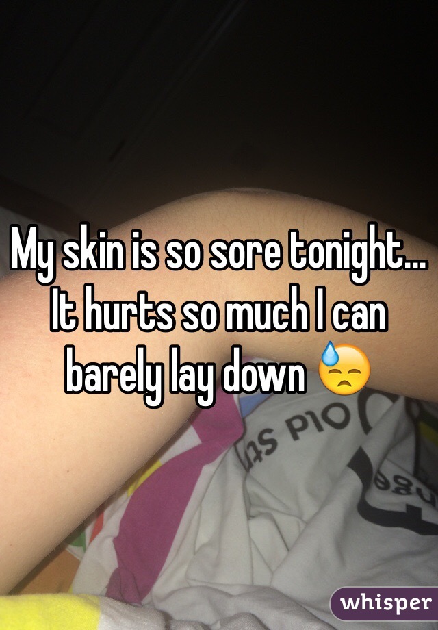 My skin is so sore tonight... It hurts so much I can barely lay down 😓