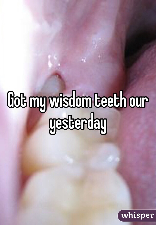 Got my wisdom teeth our yesterday 