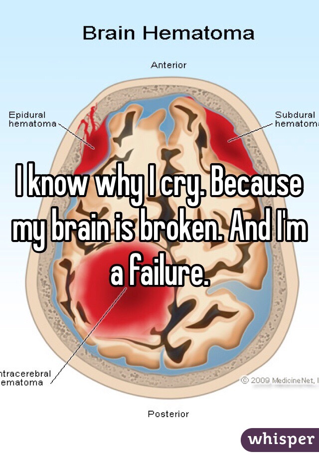 I know why I cry. Because my brain is broken. And I'm a failure.