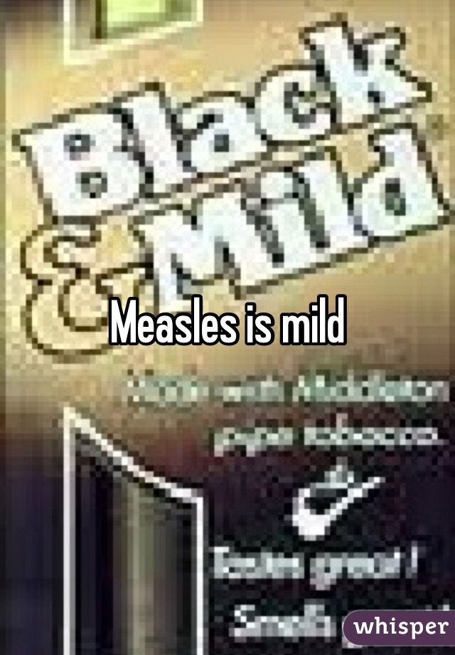 Measles is mild