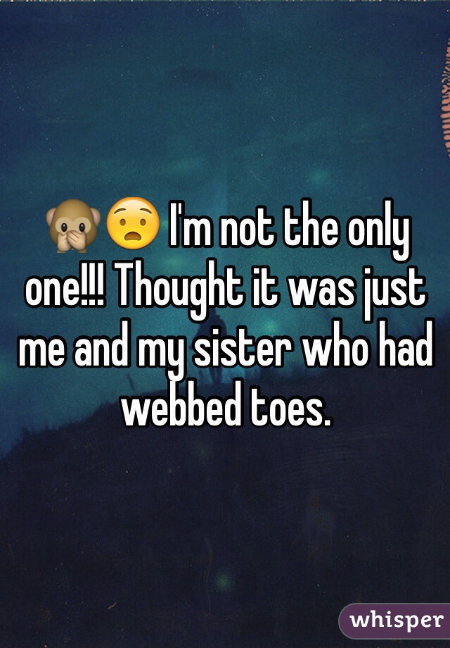 🙊😧 I'm not the only one!!! Thought it was just me and my sister who had webbed toes. 