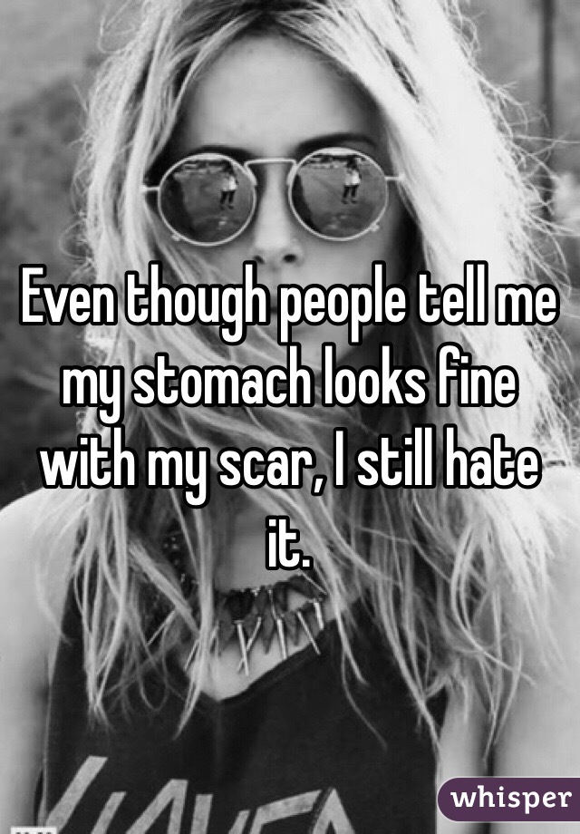 Even though people tell me my stomach looks fine with my scar, I still hate it.