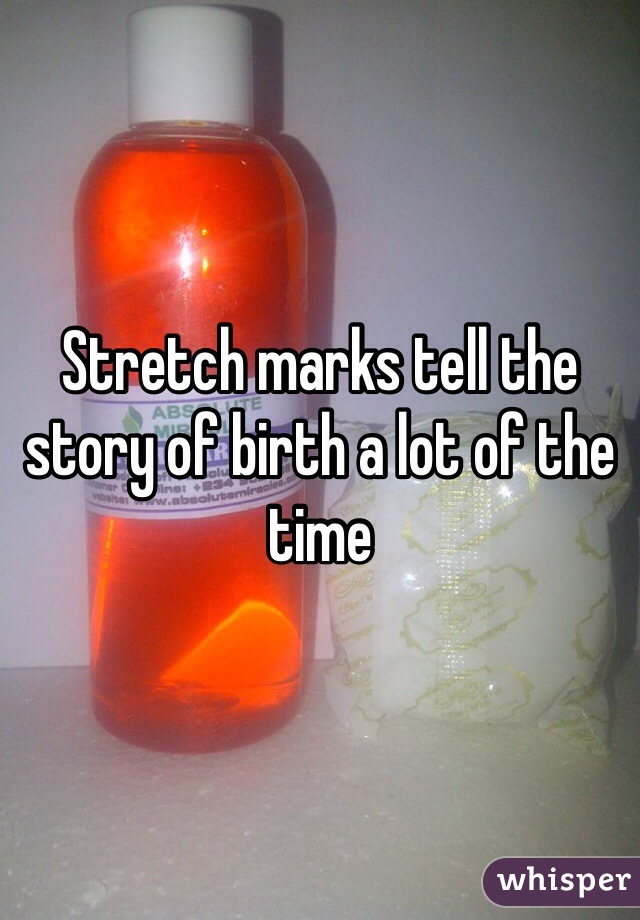 Stretch marks tell the story of birth a lot of the time 