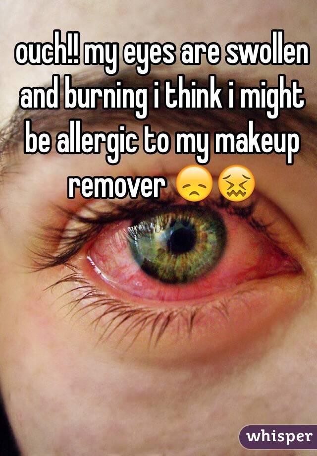 ouch!! my eyes are swollen and burning i think i might be allergic to my makeup remover 😞😖