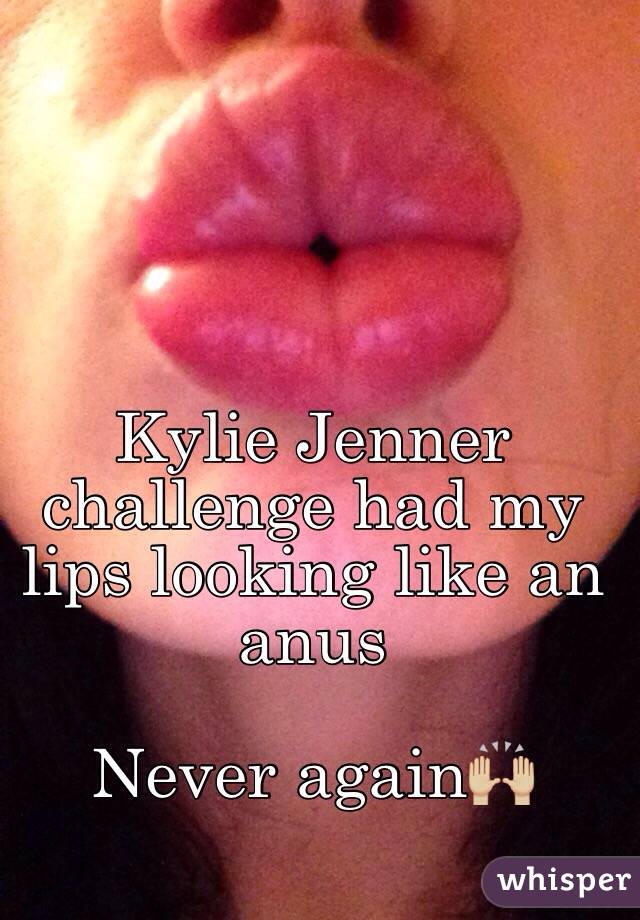 Kylie Jenner challenge had my lips looking like an anus

Never again🙌🏼
