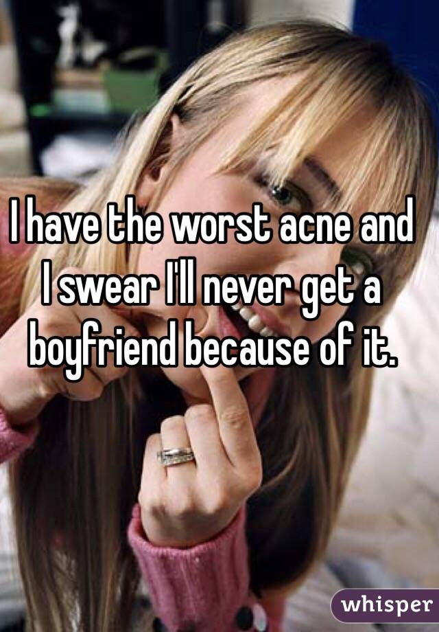 I have the worst acne and I swear I'll never get a boyfriend because of it. 