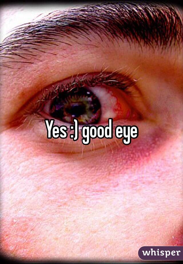 Yes :) good eye 