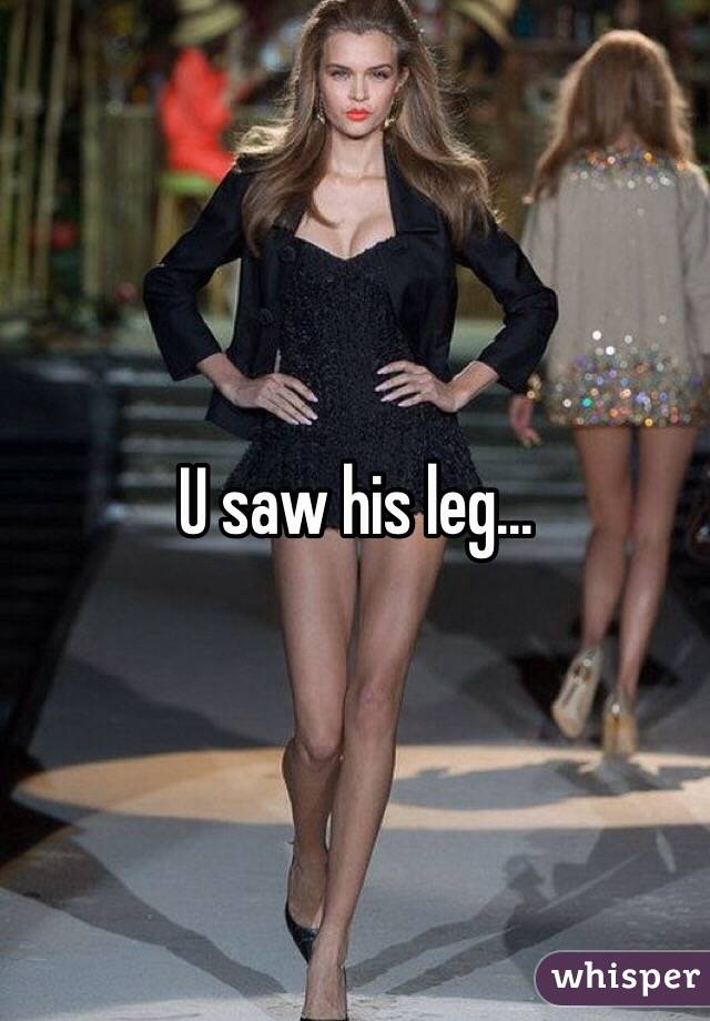 U saw his leg... 