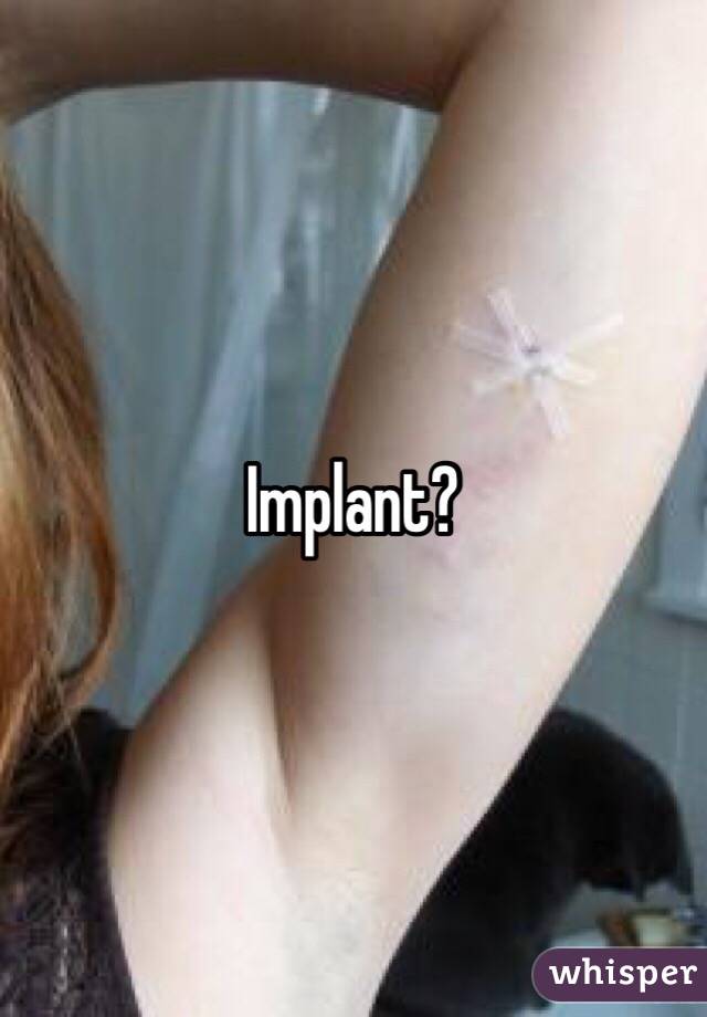 Implant?