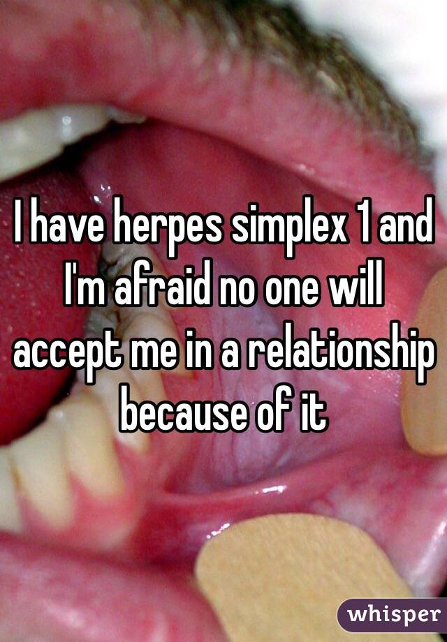 I have herpes simplex 1 and I'm afraid no one will accept me in a relationship because of it 