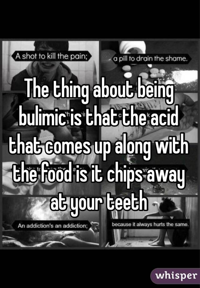 The thing about being bulimic is that the acid that comes up along with the food is it chips away at your teeth