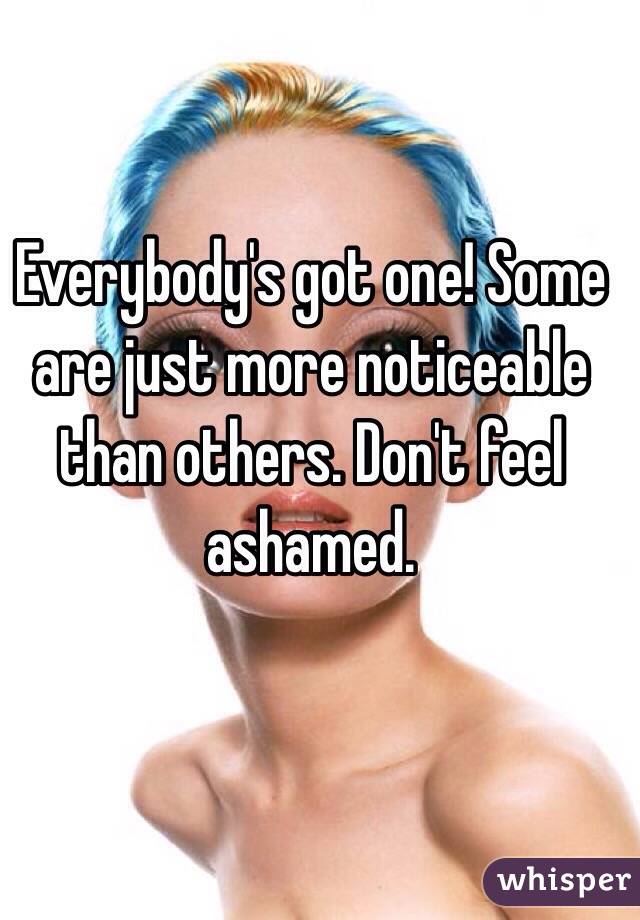 Everybody's got one! Some are just more noticeable than others. Don't feel ashamed. 