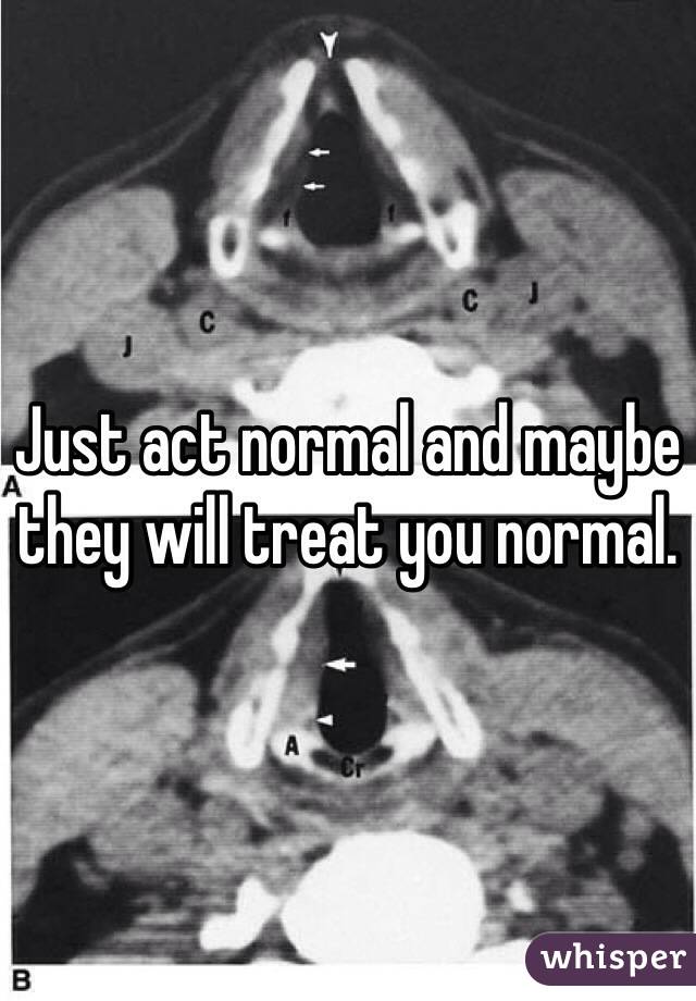 Just act normal and maybe they will treat you normal. 