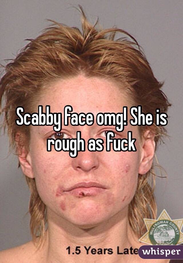 Scabby face omg! She is rough as fuck