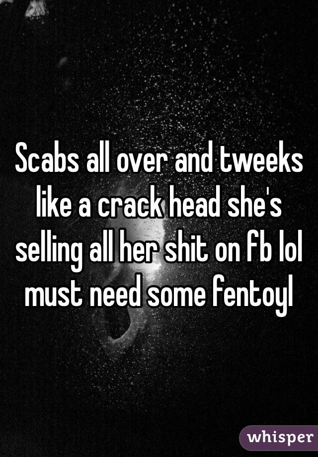 Scabs all over and tweeks like a crack head she's selling all her shit on fb lol must need some fentoyl 