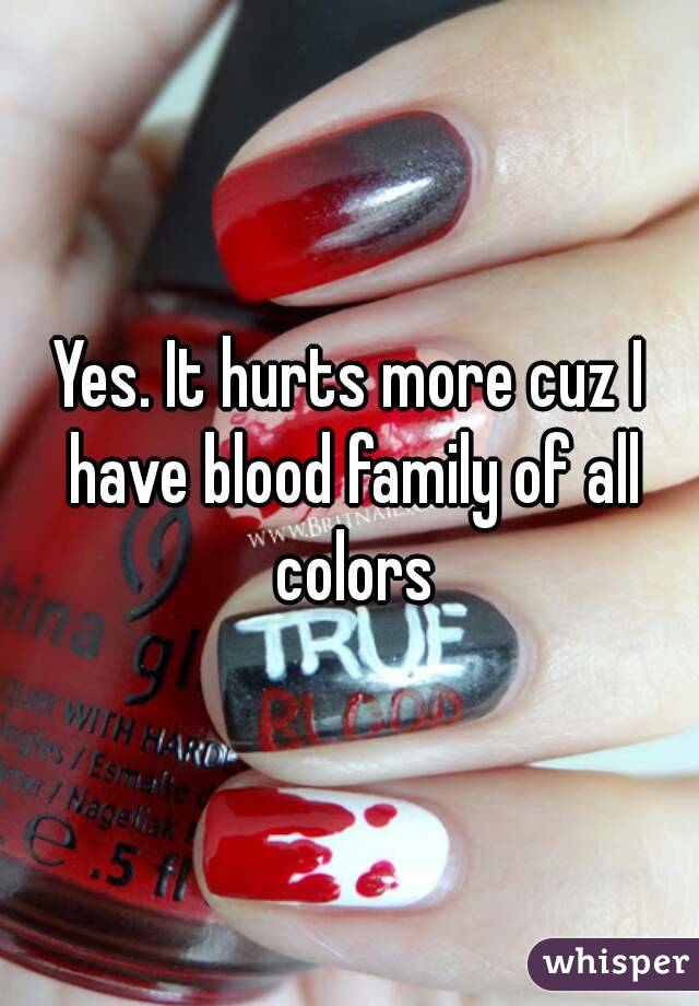 Yes. It hurts more cuz I have blood family of all colors
