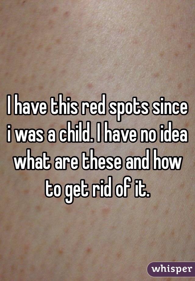 I have this red spots since i was a child. I have no idea what are these and how to get rid of it.