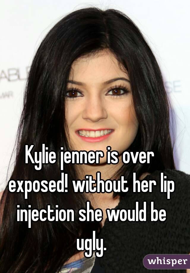 Kylie jenner is over exposed! without her lip injection she would be ugly.