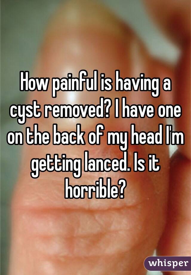 How painful is having a cyst removed? I have one on the back of my head I'm getting lanced. Is it horrible?